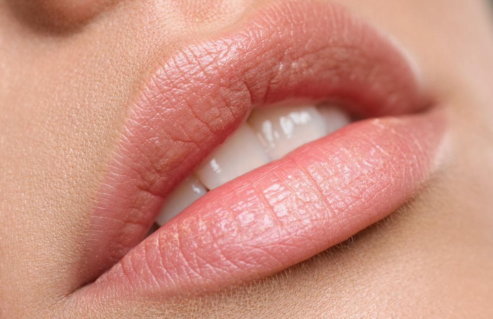 acido-hialuronico-labios-chamberi-madrid