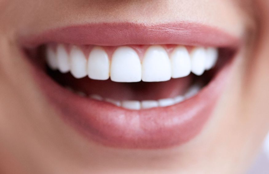 blanqueamiento-dental-profesional-en-chamberi-madrid-orthoquick