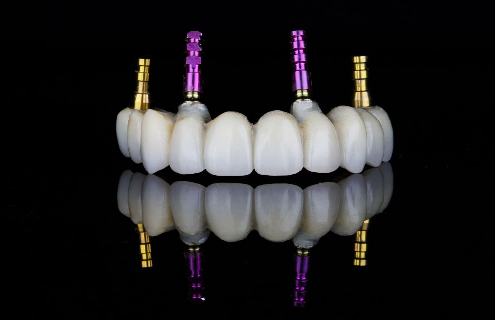 protesis-dental-fija