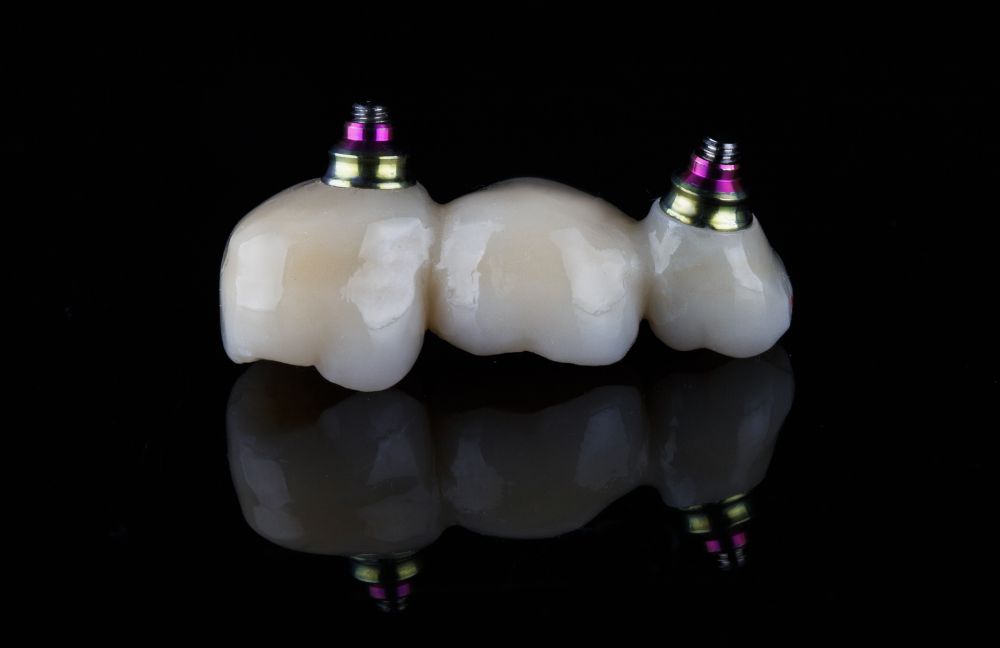 puente-dental