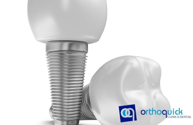 Implantes Dentales con Poco Hueso