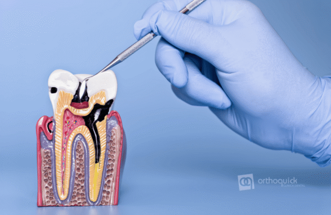 Enfermedades periodontales