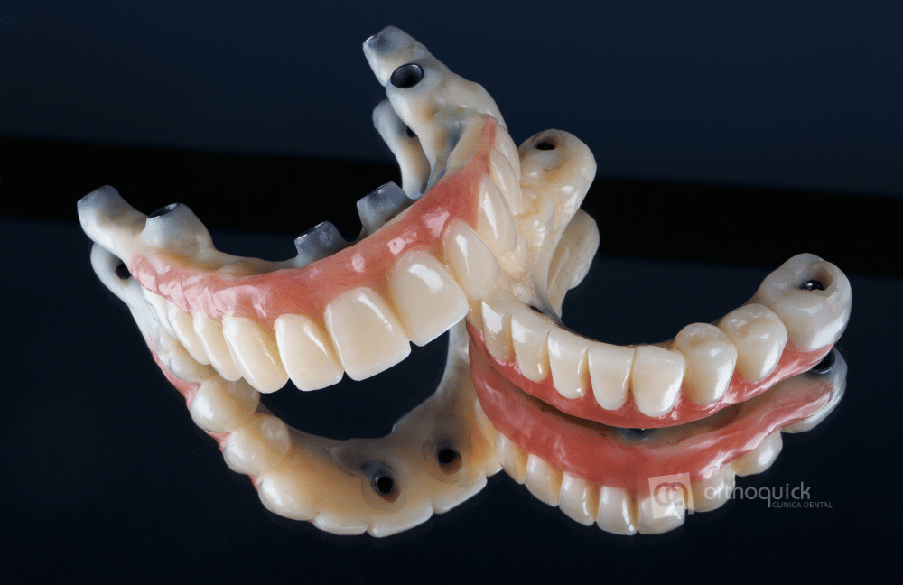 prótesis dentales